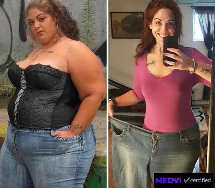 Sarah before and after