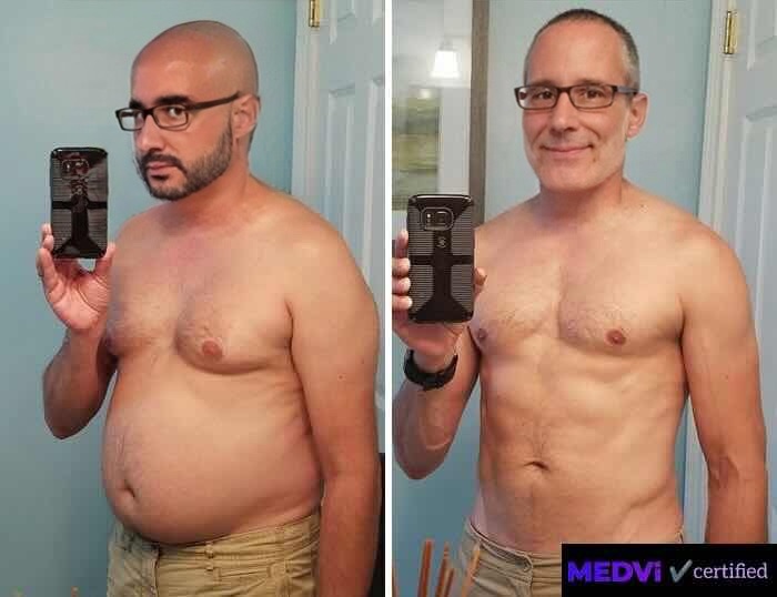 Michael before and after