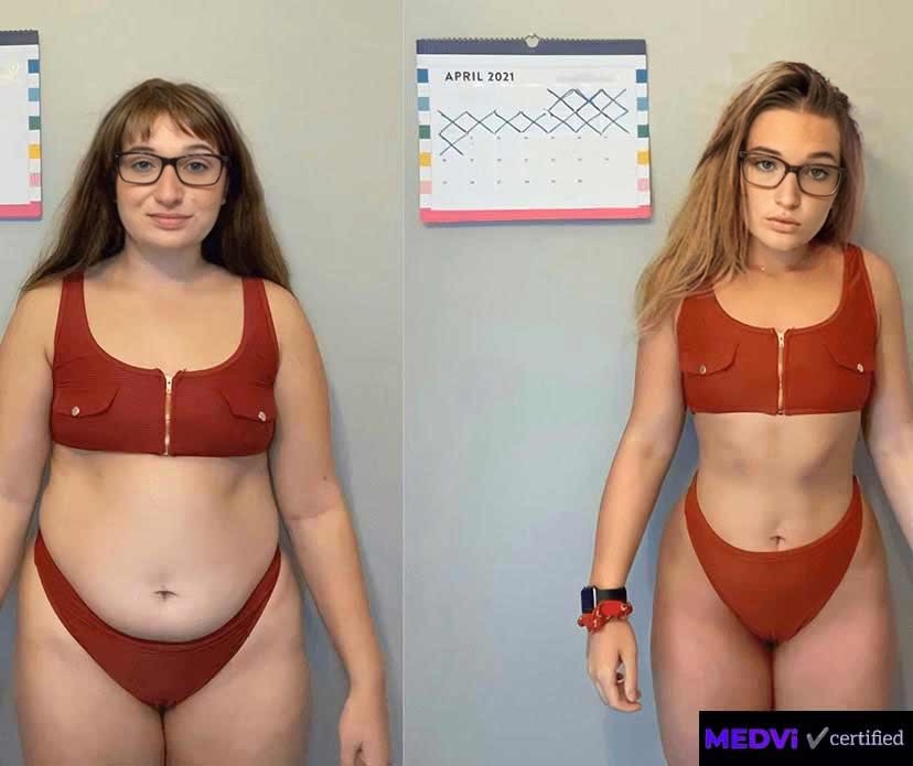 David before and after